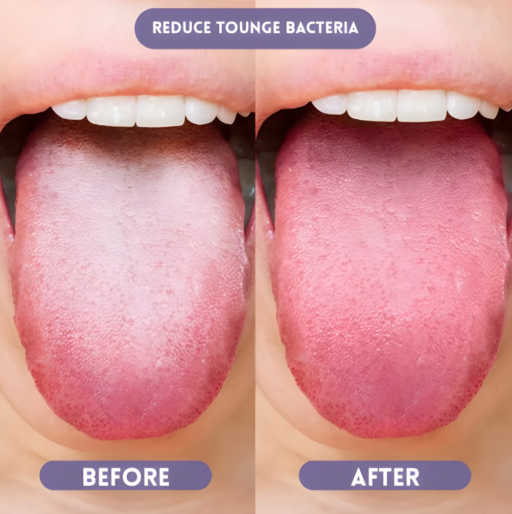 Probiotic Oral Spray